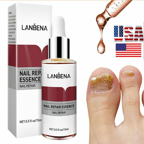 Nail repair serum fungal - nail,