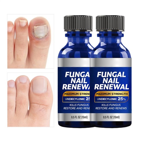 Toenail fungus treatment 15ml - fungus,