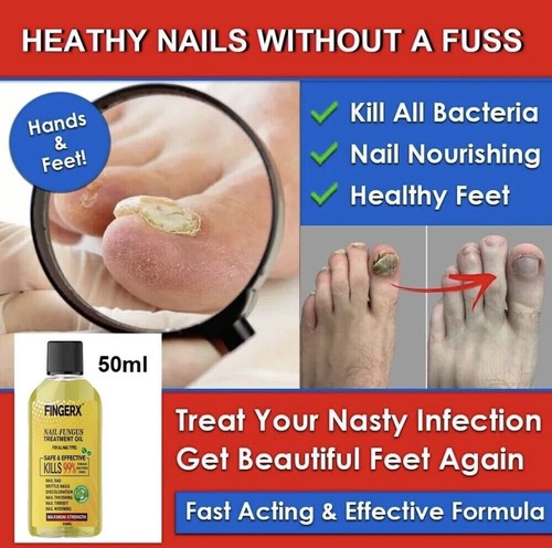 Anti fungal nail treatment - anti,