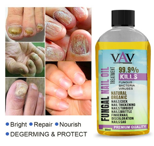 Anti fungal treatment - fungal, fungus