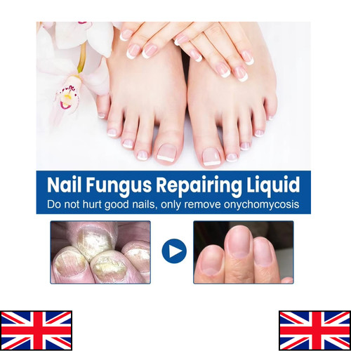 Fungal nail treatment extra - nail,