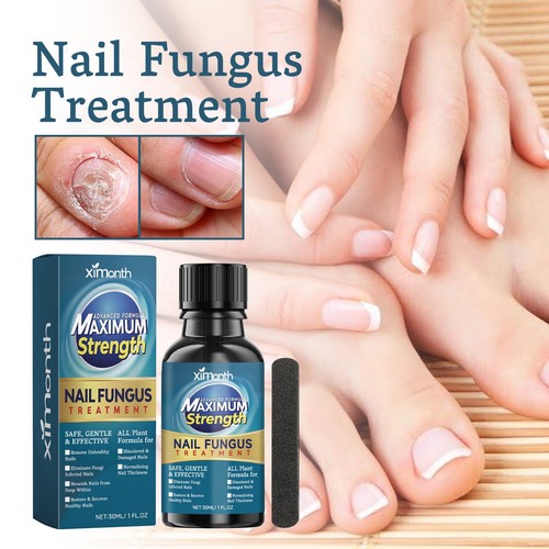 Fungal nail treatment extra - -,