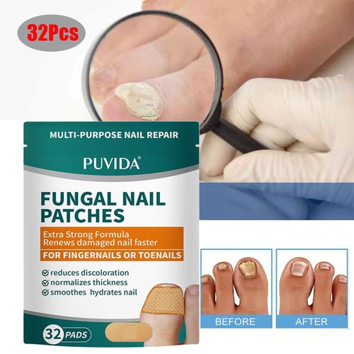 320pcs fungal nail - 32-320pcs,