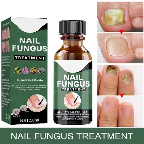 Best fungal nail treatment - best,