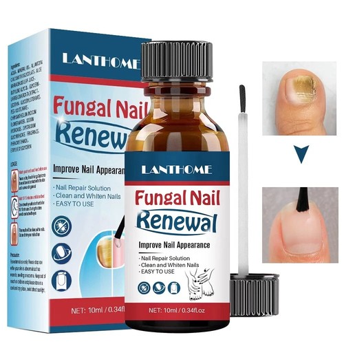 Fungal nail treatment lotion - nail,