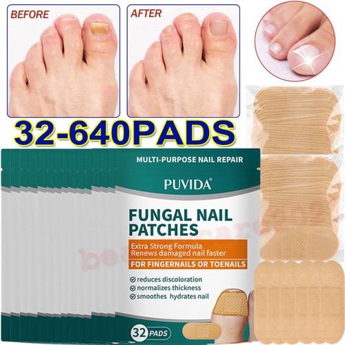 640x anti fungal - 640x,