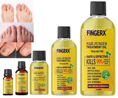 Anti fungal treatment fungus - anti,
