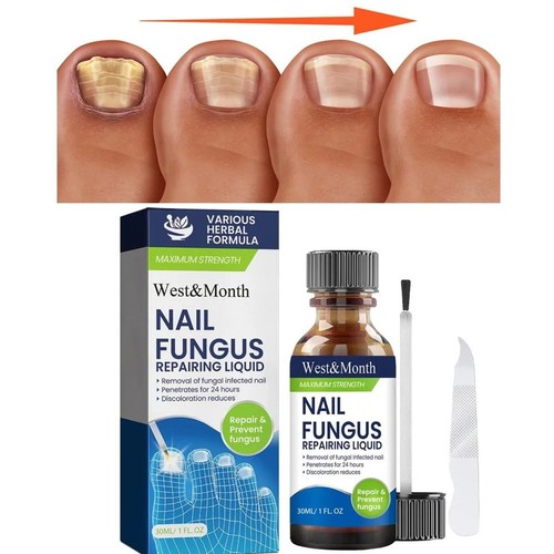 Fungal nail treatment extra - fungal,