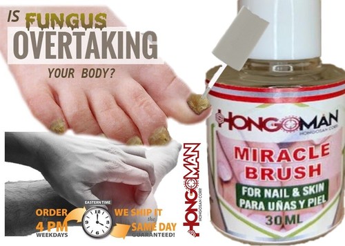 Fungus nails quick nail fungus