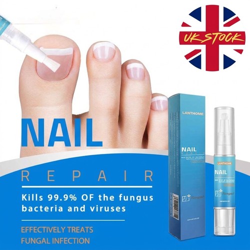 Nail fungal treatment anti - treatment,