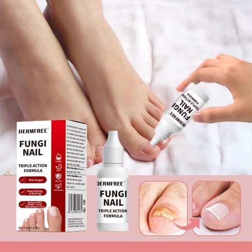 15ml fungi nail - fungi,