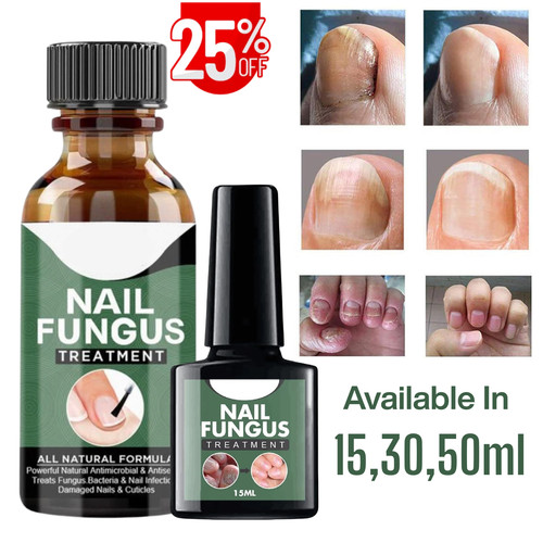 New fungal nail treatment - nail,