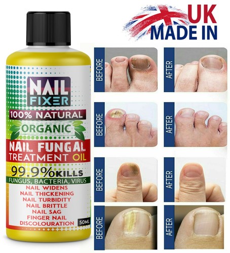 Anti fungal treatment fungus - anti,