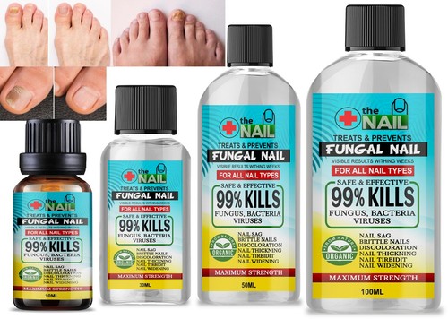 Nail fungal treatment anti - nail,