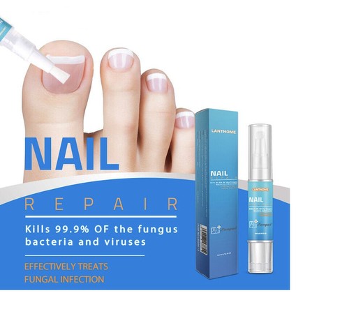 Fungal nail treatment stops - fungal,