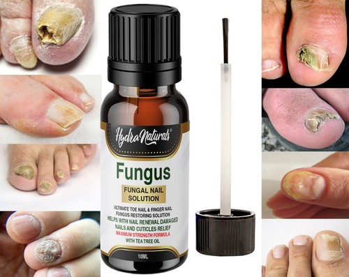 Nail plus fungal - nail-plus,