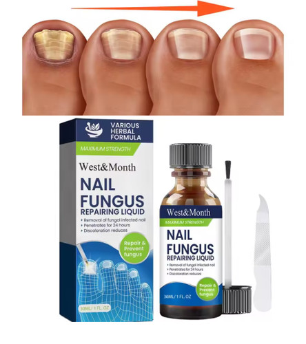 Fungal nail treatment extra - fungal,
