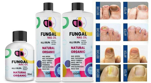 Anti fungal treatment fungus - anti,