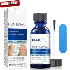 Nail Fungus Treatment for