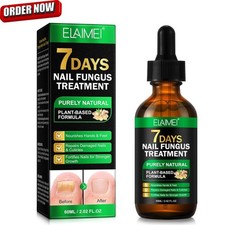Nail Fungus Treatment for