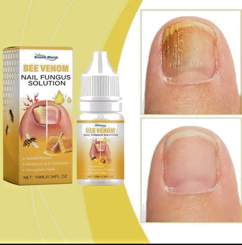 Maximum strength nail fungus - nail,