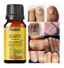 BEST Fungal Nail Treatment -
