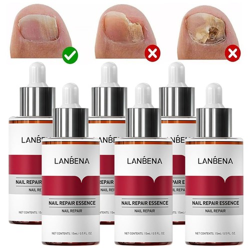 Nail repair serum fungal - repair,