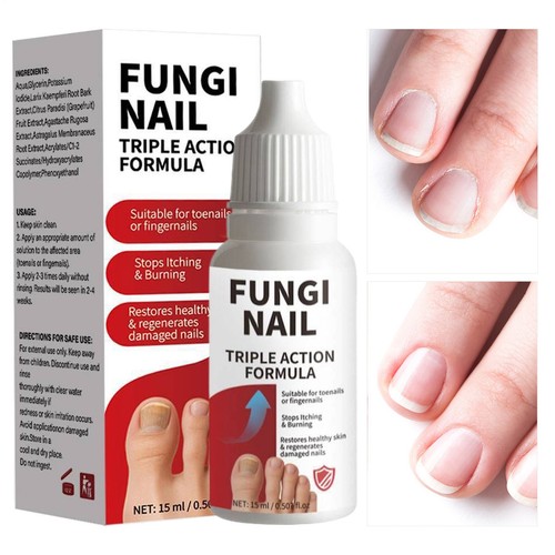 Anti fungal liquid formula - anti,