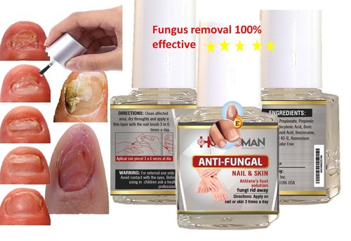 Anti fungal support - fungal,