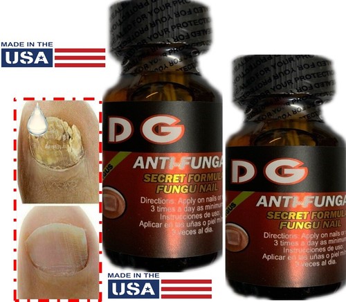 Anti fungal nail - nail, support
