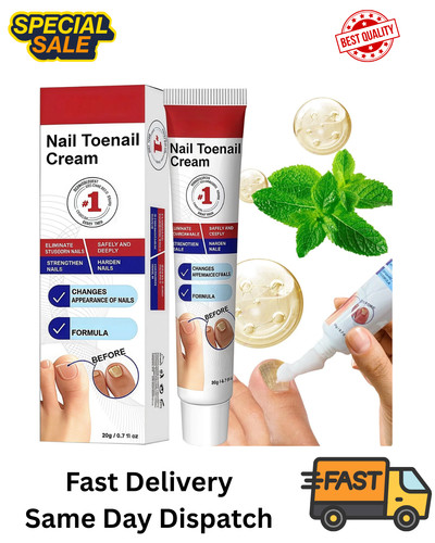 Fungal nail treatment - nail, cream