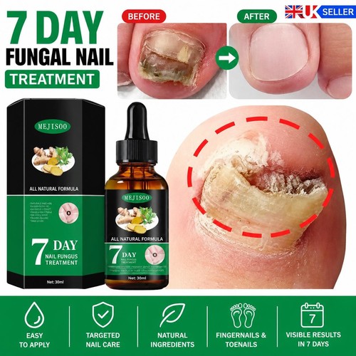 Fungal nail treatment - fungal,