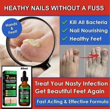 ANTI FUNGAL NAIL TREATMENT