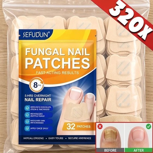 320 fungal nail - fungal,