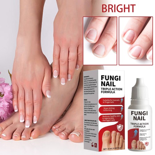 Fungi nail anti fungal liquid - nail,