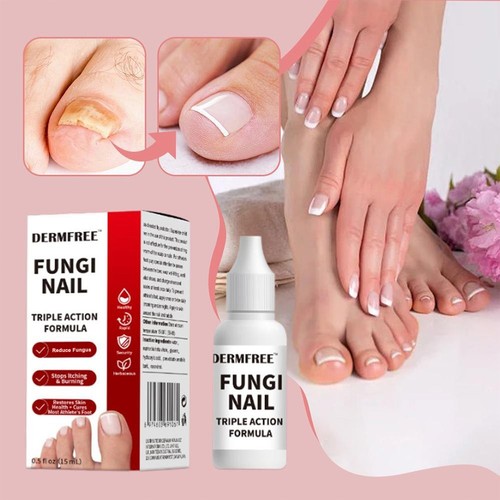 15ml fungi nail - fungi,