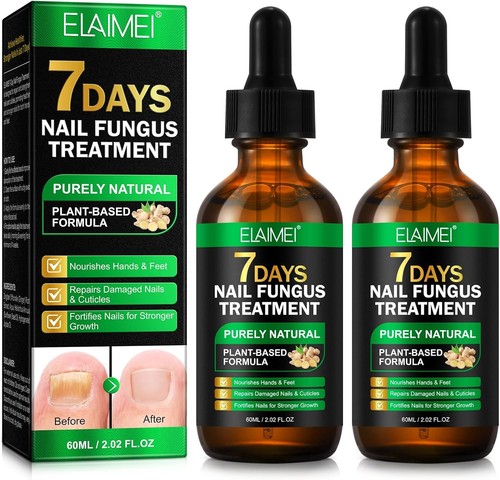 Fungal nail treatment - nail,